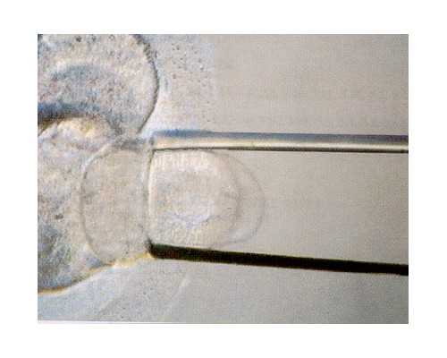排名第首都医科大学附属北京安贞医院生殖中心