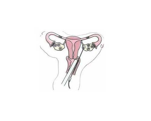 北京借卵哪里好,北京三代试管费用和成功率