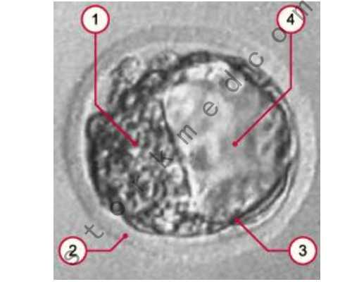 试管婴儿辩论赛正方总结：全面解析支持试管婴儿的五大理由