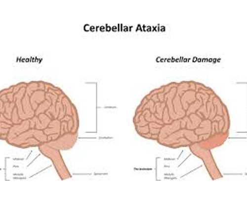 北京代孕一般需多少钱|新疆佳音医院做试管婴儿多少钱？三代试管费用贵吗？