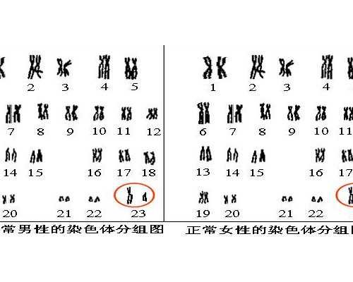 [做试管使用激素的副作用]做试管婴儿用大量激素的副作用是会引起抑郁吗？*捐卵机构