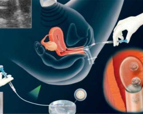 北京大龄供卵供卵代孕,北京供卵机构靠谱,北京市昌平区三代供卵代孕价格