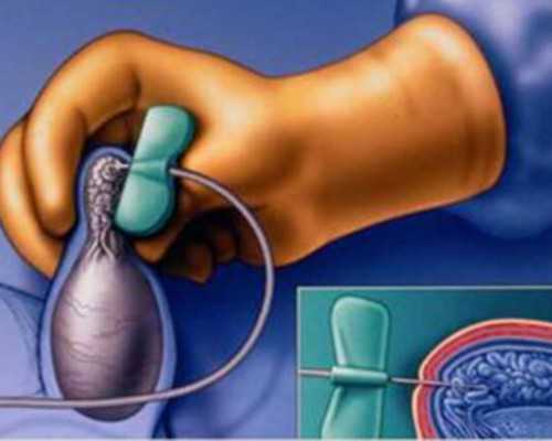 北京代孕私立医院,北京家圆医院供卵费用（北京家圆医院怎么样？）