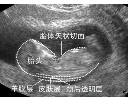 北京不育不孕治疗：北京治疗不孕不育的医生*代怀中心