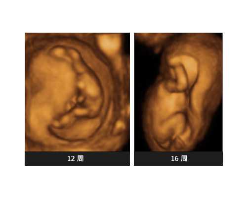 北京代怀包男宝&北京供卵技术,，焦点访谈北京供卵代孕孩子中介