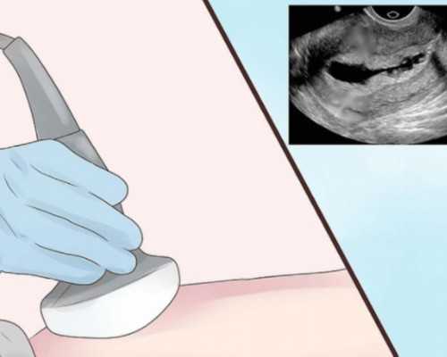 为什么试管做无创属于慎用人群？试管到底用不用做无创？*助孕生男孩