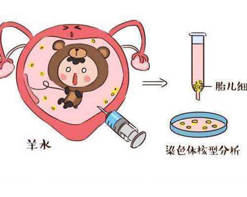 带环后为什么会出血，带环后出血几天正常