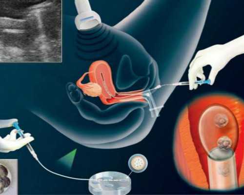 北京助孕孩子qq群二维码,2026年在北京妇产医院做一次试管婴儿大概要多少钱？