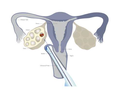 北京试管婴儿生子十大医院排名！试管婴儿北京医院排名最好！