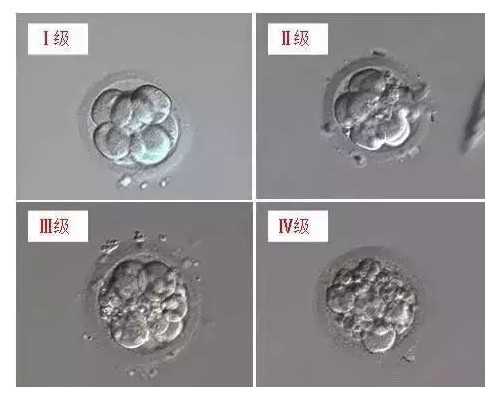 北京借卵子代怀吗|佛山供卵试管生一对龙凤胎需要多少钱？附生男孩费用一览