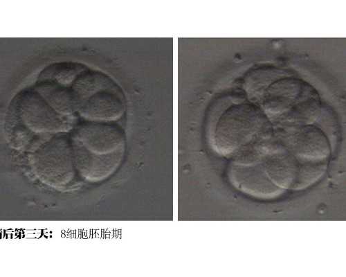 北京爱心代怀-北京供卵官方网站,北京三代供卵代孕包男孩靠谱吗