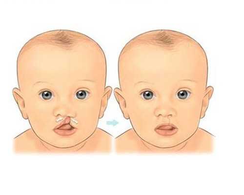 孕期如何安全用药*代生代怀机构