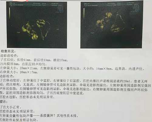 北京大学深圳医院试管婴儿有哪些流程步骤呢！北京大学深圳医院试管婴儿医生