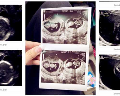 lh试纸尿检阴性就是没有排卵吗？*供卵代怀医院