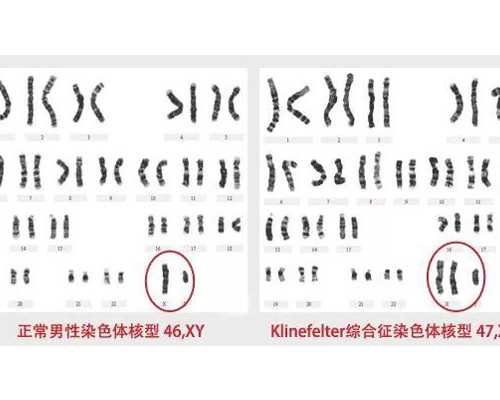 北京代生网哪家机构好用,北京朝阳医院做人工授精全部流程下来费用多少？